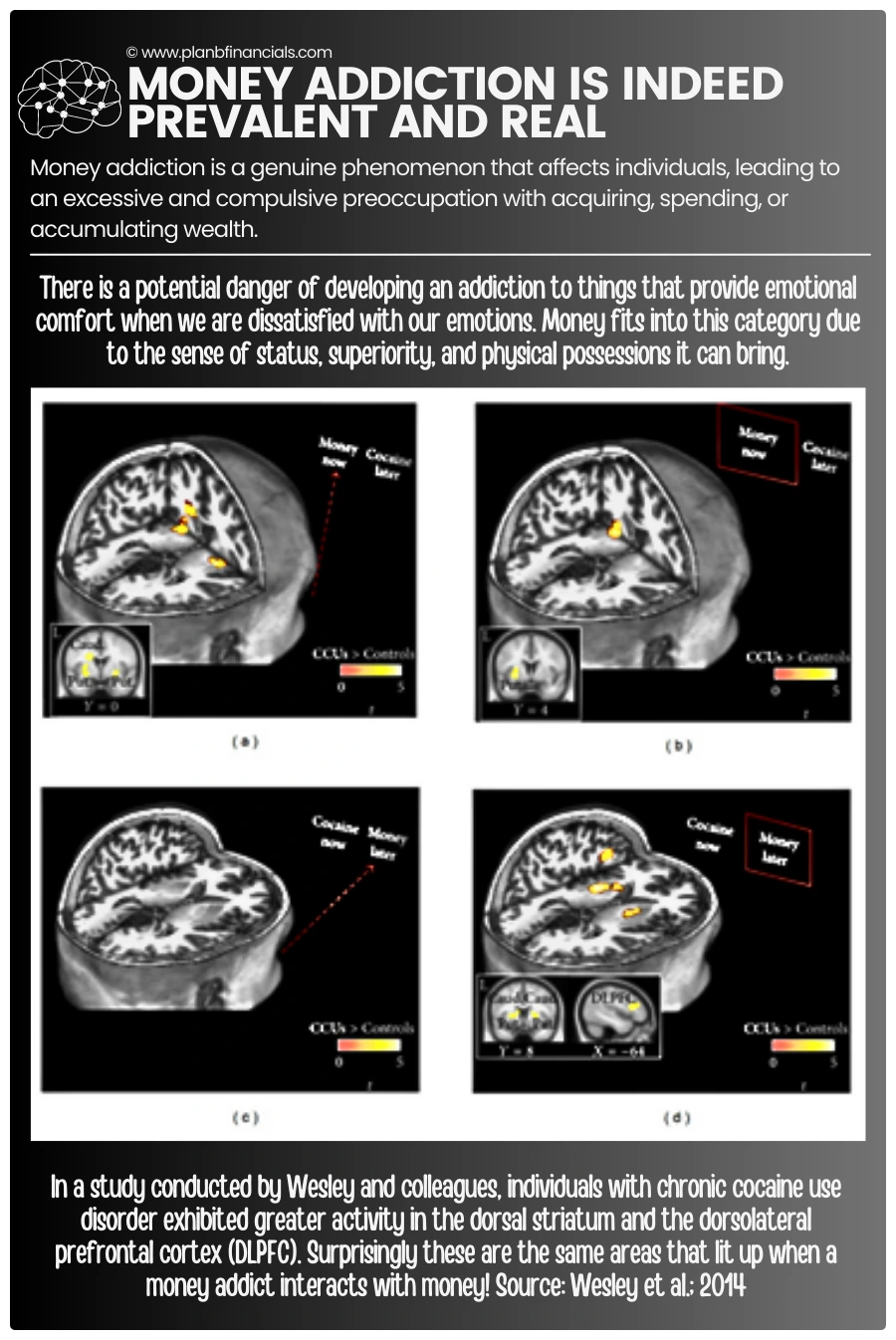 money-addiction-ct-scan